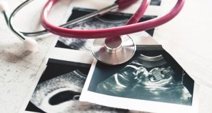Daily consumption of diet sodas and aspartame-sweetened drinks during pregnancy associated with autism in male children.