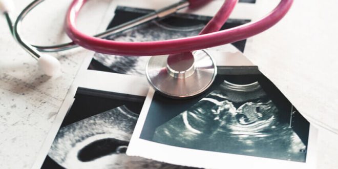 Daily consumption of diet sodas and aspartame-sweetened drinks during pregnancy associated with autism in male children.