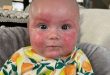 Infant Formula Rules Shift Lauded, Paving Way for Dairy-Free Formula.