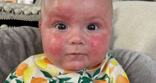 Infant Formula Rules Shift Lauded, Paving Way for Dairy-Free Formula.