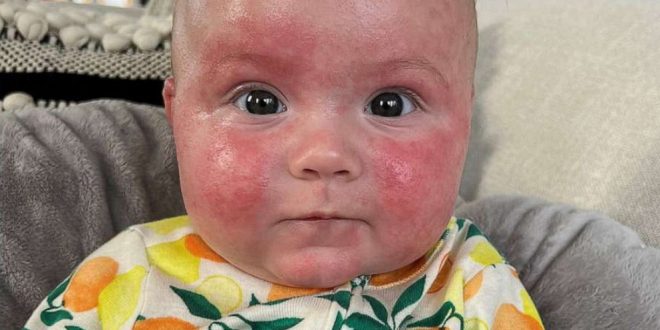 Infant Formula Rules Shift Lauded, Paving Way for Dairy-Free Formula.