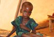 Nutrition rehabilitation center opens for malnourished children.