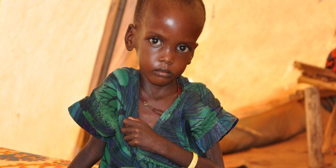 Nutrition rehabilitation center opens for malnourished children.
