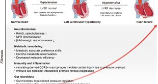Frequently used medication for myocardial infarction ineffective and could elevate mortality risk for select women, new research indicates.