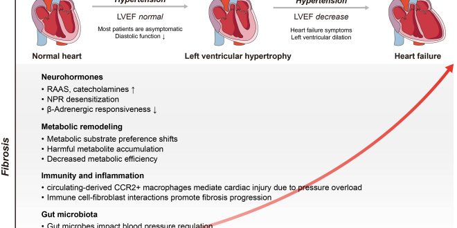 Frequently used medication for myocardial infarction ineffective and could elevate mortality risk for select women, new research indicates.