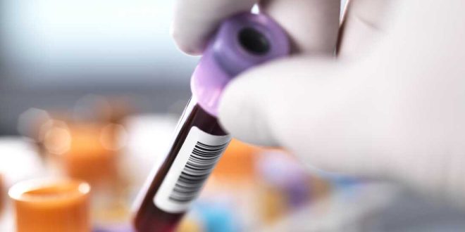 Gene editing shows promise for permanently lowering high cholesterol.